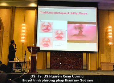 VÁ SỨT MÔI THẨM MỸ TOÀN DIỆN